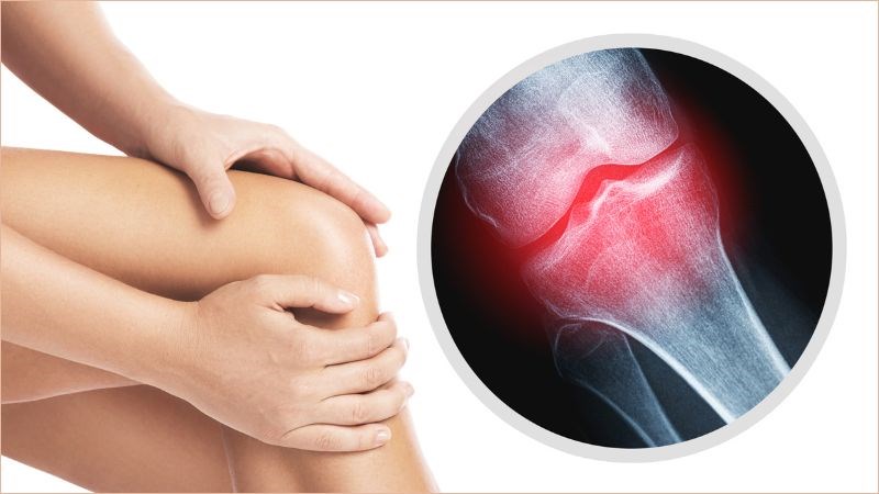 tác dụng collagen với xương khớp