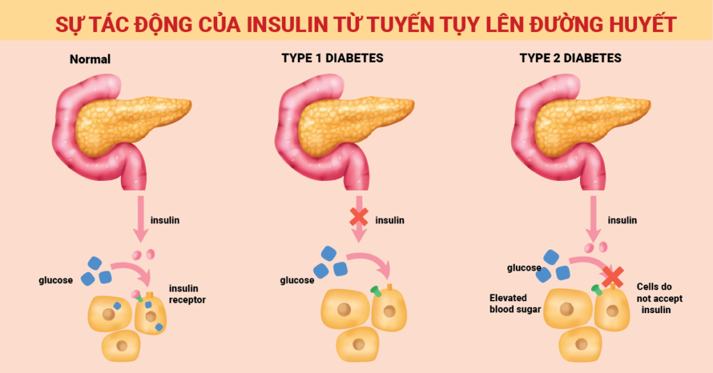đường phèn với tuyến tụy